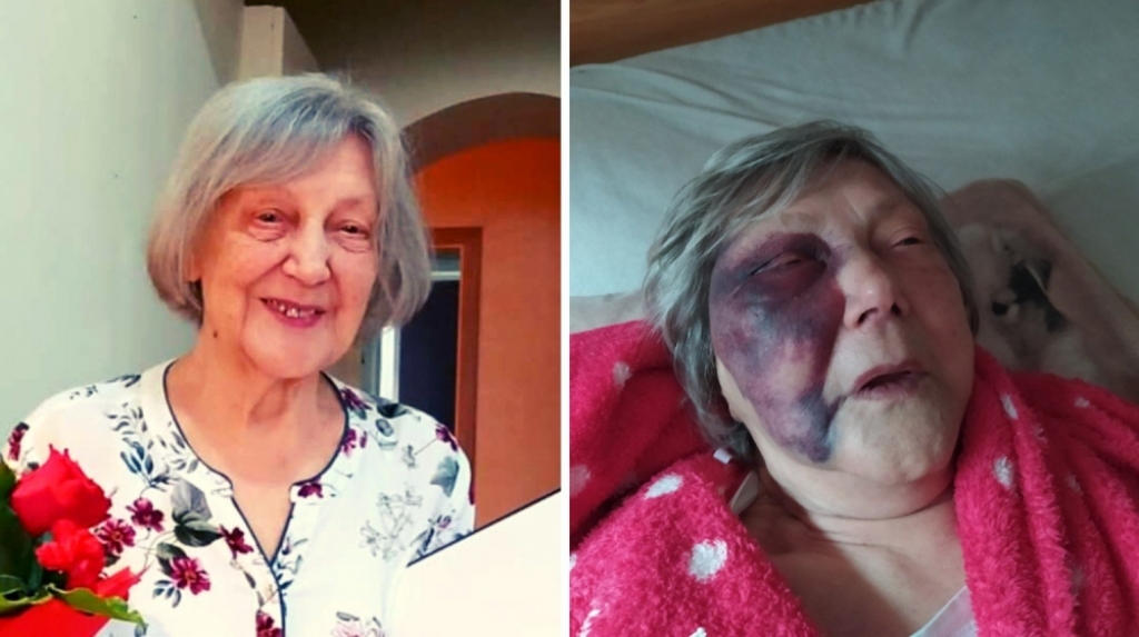 Oławski SOR jak z horroru - fot. zrzutka.pl
