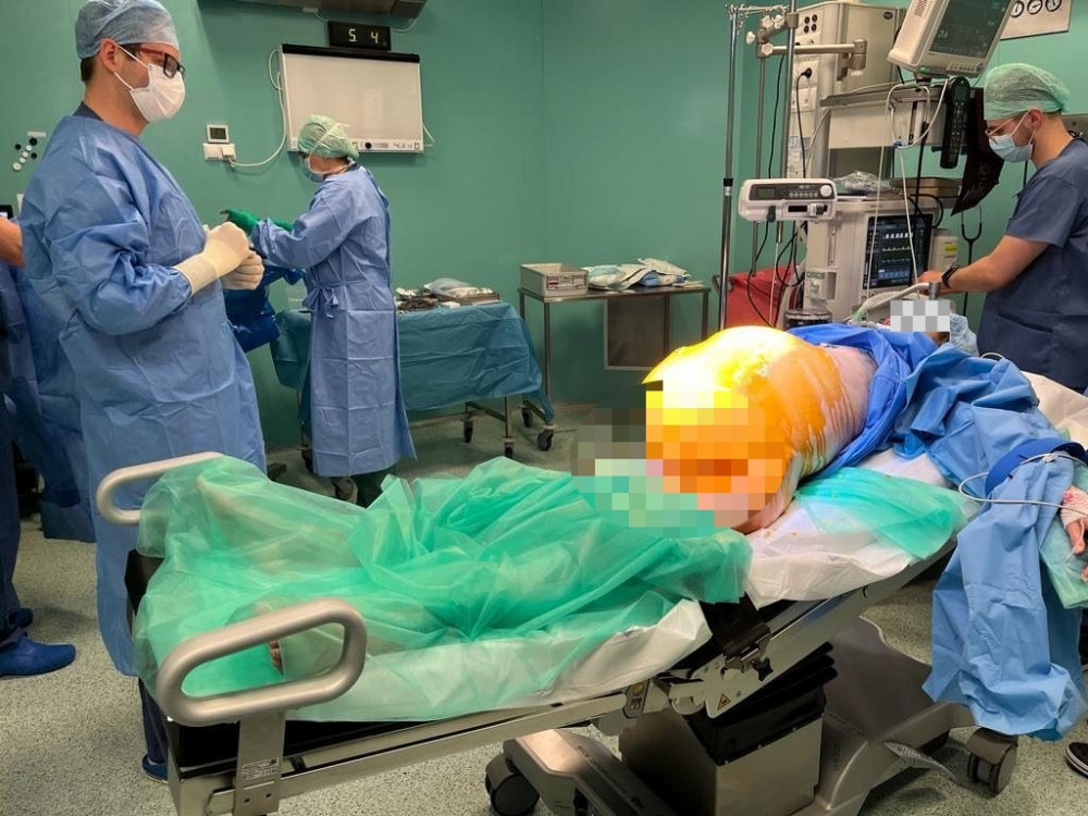 Lekarze usunęli pacjentce gigantycznego guza. Ważył blisko 20 kilogramów - fot. Samodzielny Publiczny Zespół Opieki Zdrowotnej w Świdnicy/Szpital Latawiec / Facebook