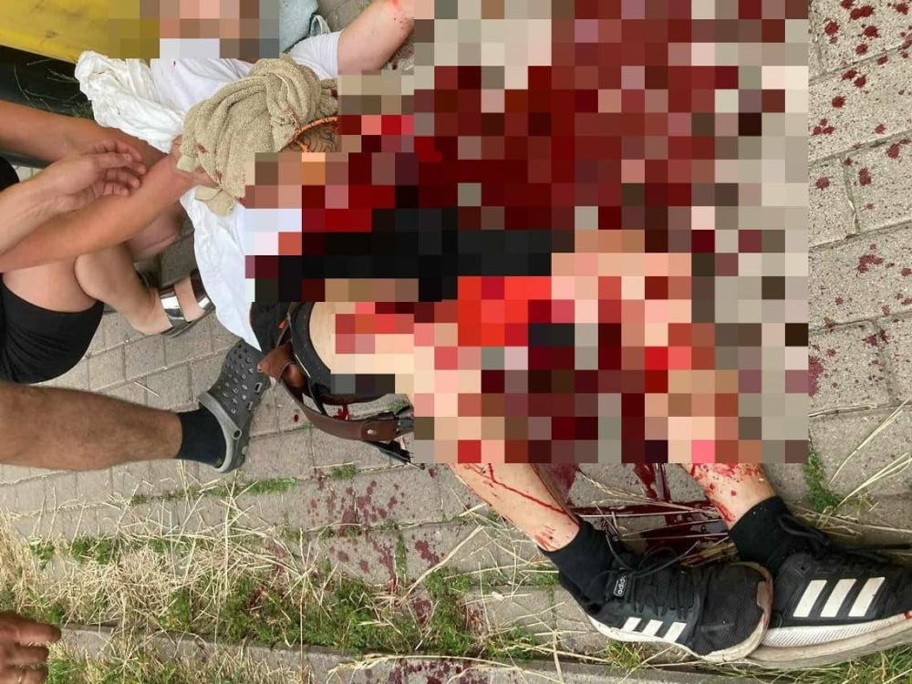 Zarzut usiłowania zabójstwa dla napastnika z mieczem samurajskim [ZDJĘCIA +18] - fot. Telewizja Dami Region