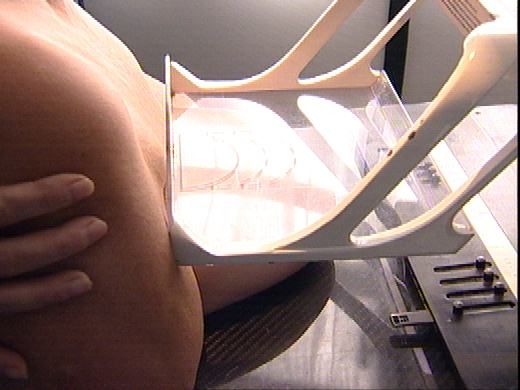 Bezpłatne badania mammograficzne - fot. TVP