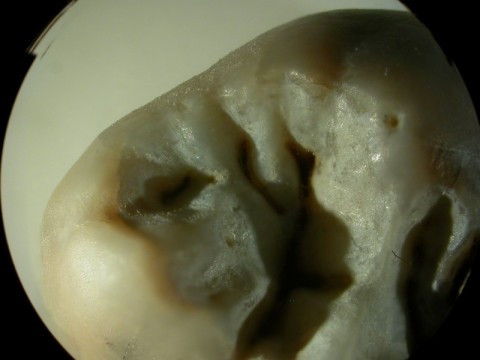 Zbadali zęby neandertalczyków - 3