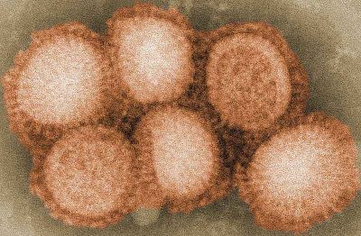 Świdnica: 40-latek ciężko chory na grypę AH1N1 czuje się lepiej - Wirus AH1N1 (Fot. Wikipedia / Cybercobra)