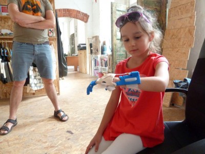 Wydrukowali dla 9-letniej Julii protezę dłoni (ZOBACZ) - 5