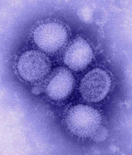 Zarażeni wirusem AH1N1 będą leczeni w domach - Wirus nowej grypy (Fot. Wikipedia)