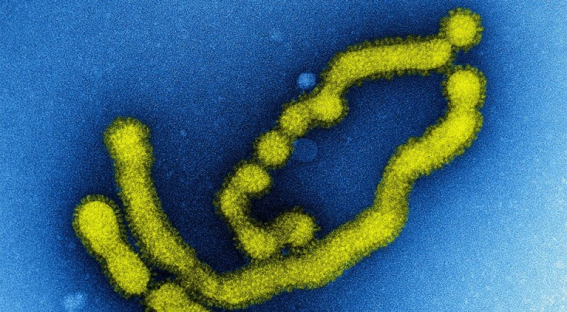 Świńska grypa: Trwa walka o życie pacjentki trzebnickiego szpitala - fot. flickr/NIAID/CC 2/0