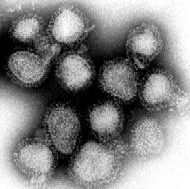 Grypa atakuje z prędkością 170 km na godz. Szczepmy się! (Posłuchaj) - Wirus grypy (Fot. Wikipedia)