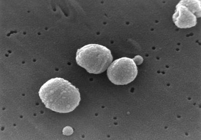 Czy szczepić dzieci przeciw pneumokokom? (Posłuchaj) - Pneumokoki (Fot. Wikipedia)