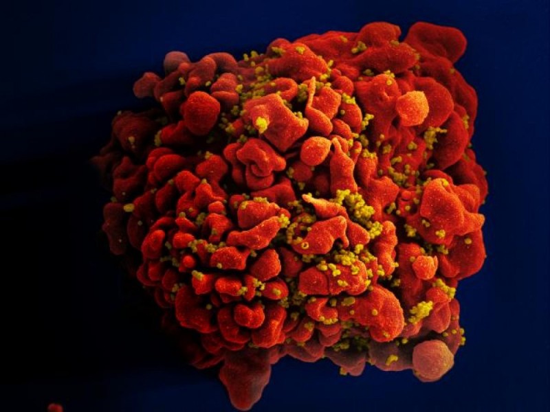 Połowa osób zarażonych wirusem HIV o tym nie wie - NIAID / wikipedia / CC 2.0