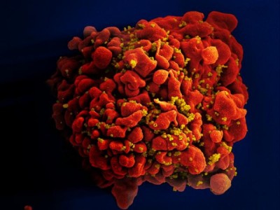 Połowa os&oacute;b zarażonych wirusem HIV o tym nie wie