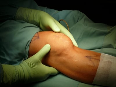 Wrocławscy lekarze zrobili pierwszy w Europie i drugi na świecie przeszczep rzepki kolana - 7