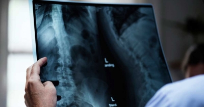 Specjalistyczny rentgen z Obornik Śląskich trafi do szpitala na Ukrainie