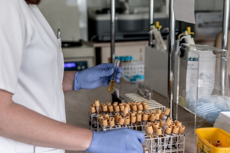 Koronawirus. Laboratorium w Dreźnie będzie badało próbki Dolnoślązaków - zdjęcie ilustracyjne; fot. pixabay