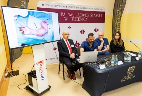 Lekarze z Trzebnicy przyszyli pacjentowi rękę oderwaną na wysokości ramienia - 18