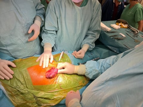 USK: Pierwsza w Polsce jednoczesna retransplantacja serca i transplantacja nerki - 3