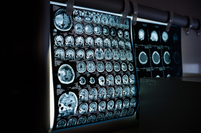 Wyższy poziom diagnostyki w Zgorzelcu. Do szpitala trafiły nowe rezonanse i tomografy