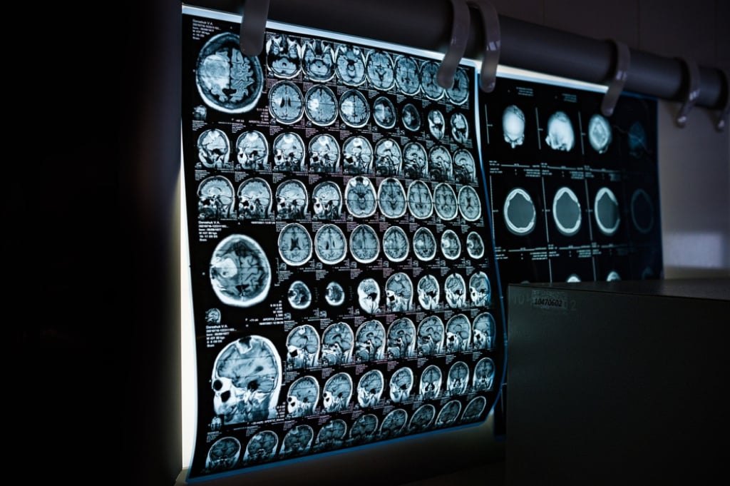 Wyższy poziom diagnostyki w Zgorzelcu. Do szpitala trafiły nowe rezonanse i tomografy - Nowy poziom diagnostyki w Zgorzelcu. Zdjęcie ilustracyjne. Fot. Pixabay