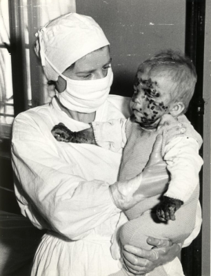 "Nie wracałam do domu, bo się bałam". 62. rocznica epidemii czarnej ospy we Wrocławiu [ARCHIWALNE ZDJĘCIA] - 5