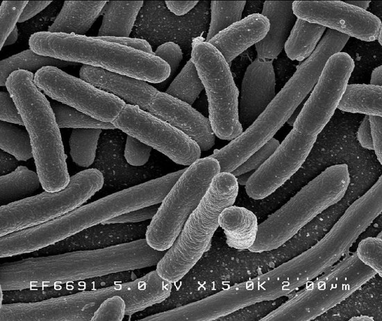 Bakteria E. coli u naszych sąsiadów - Fot. Wikipedia