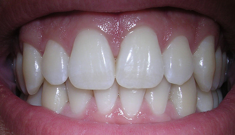 Polacy nie dbają o zęby - Fot. Dozenist/Wikipedia