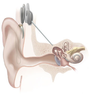 Darmowe badania słuchu dla seniorów - Fot. Wikipedia