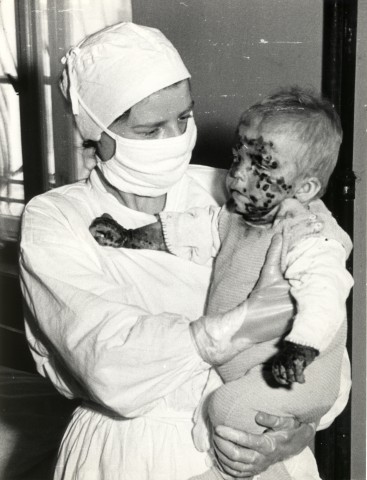 Z ARCHIWUM: Epidemia ospy we Wrocławiu (UNIKATOWE ZDJĘCIA) - 6