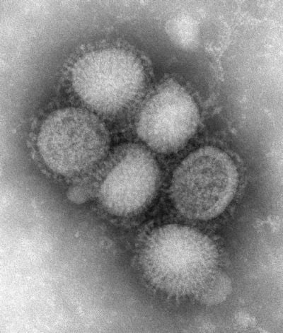 Wrocław: podejrzenie świńskiej grypy - Wirus świńskiej grypy (Fot. Wikipedia / C. S. Goldsmith and A. Balish, CDC)