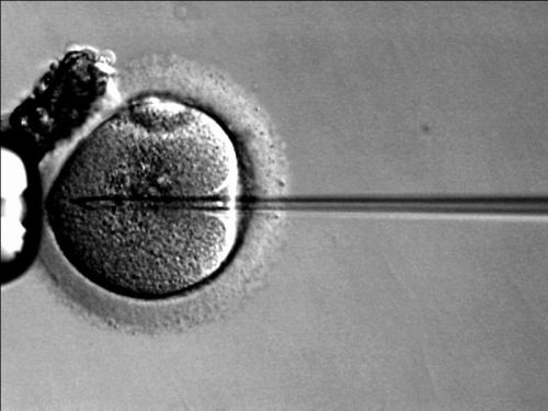 Czy dzieci z próbówki są gorsze? Spór o in vitro (Posłuchaj) - Tak wygląda sztuczne zapłodnienie (Fot. Wikipedia)