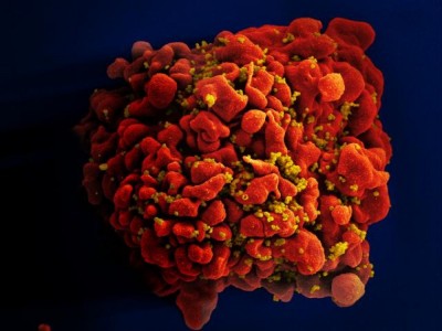 Połowa osób zarażonych wirusem HIV o tym nie wie