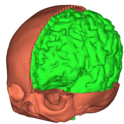 Numeryczne modelowanie mózgu człowieka