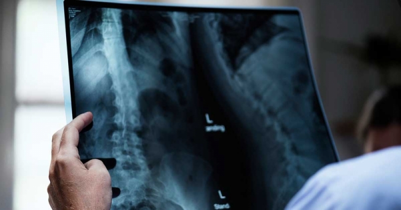 Specjalistyczny rentgen z Obornik Śląskich trafi do szpitala na Ukrainie - Zdjęcie ilustracyjne (fot. Pixabay)