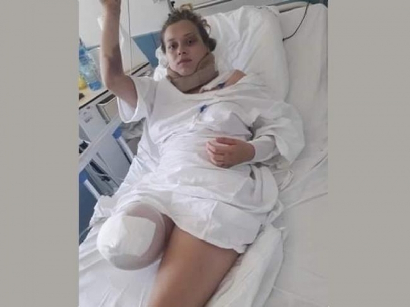 19-letnia Tatiana prosi o pomoc w zakupie protezy nogi - fot. siepomaga.pl 